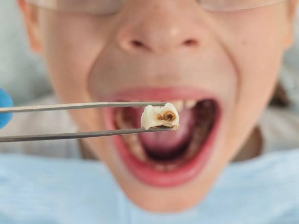 Best Emergency Denture Repair in Red Springs, NC